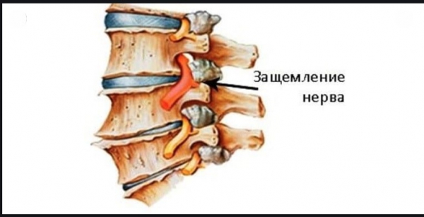 Смешные картинки про боль в спине