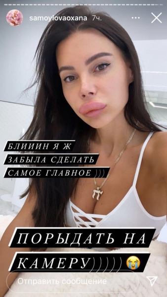 За естественную красоту! Оксана Самойлова решила уменьшить губы