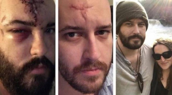Эти люди бросили пить алкоголь, и вы только взгляните как сильно они изменились люди отказавшиеся от алкоголя бросили пить до и после люди до и после того как бросили пить отказ от алкоголя до и после