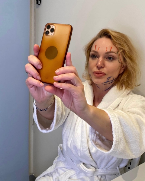 Алла Довлатова рассказала, что решилась на пластику лица
